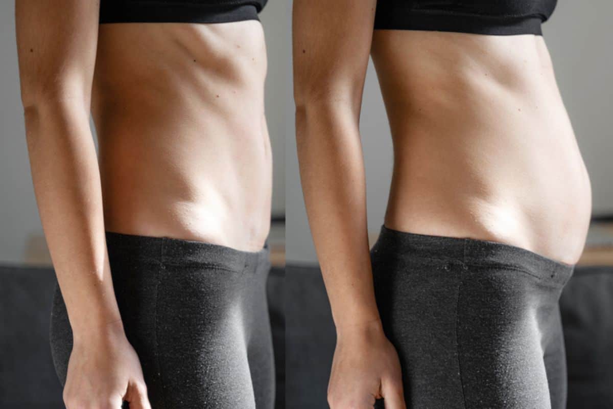 How long does diastasis recti take to improve Hyde Park Corner?