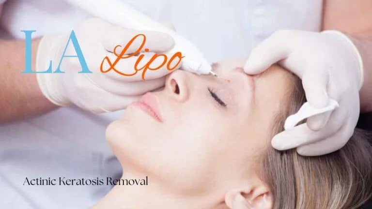 Woman receiving Actinic Keratosis Removal Treatment Hyde Park Corner
