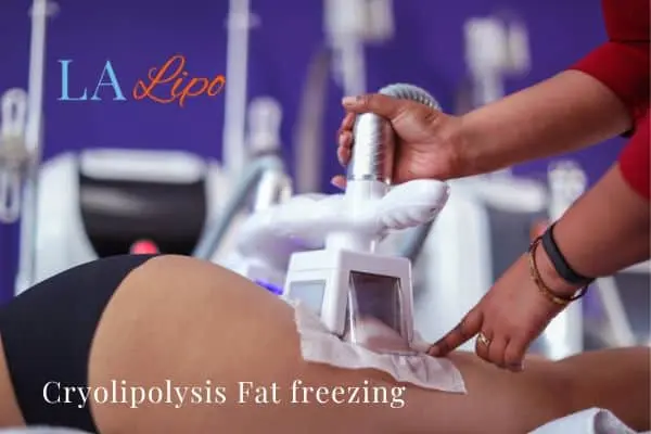 women getting fat freezing Hyde Park Corner