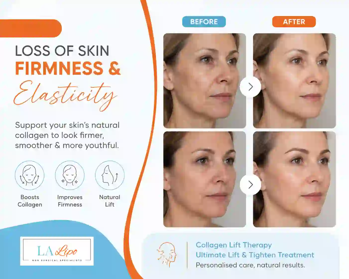 Sign #7: Loss of Skin Firmness and Elasticity Hyde Park Corner